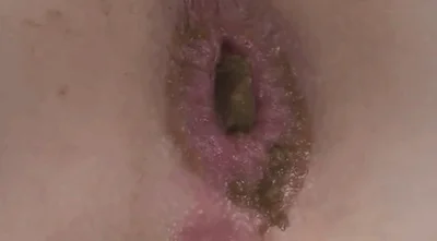 女孩在床上拉屎-视频3