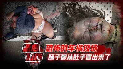 恐怖的车祸现场肠子都从肚子冒出来了