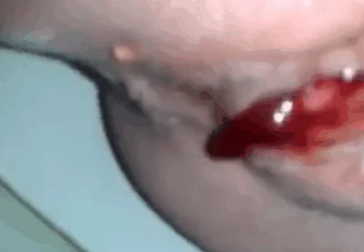 Close-up of a woman defecating during her menstrual period