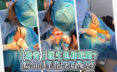 【猎奇】医生也扣屁眼？ 这tmd 取出来的是啥？